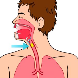 premiers secours-étouffement-gestes qui sauvent-illustration