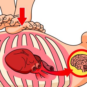 premiers secours-massage-cardiaque-gestes qui sauvent-illustration